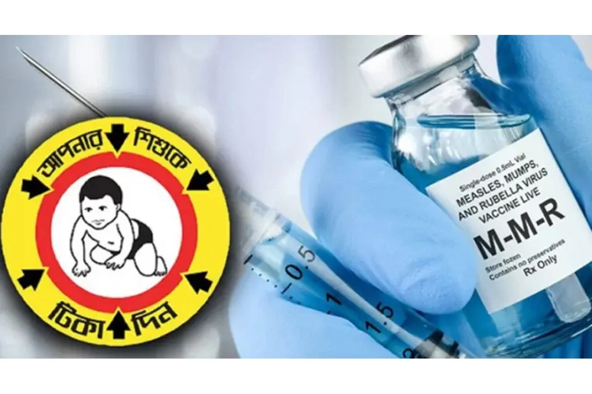 হামের বিশেষ টিকাদান কর্মসূচি শুরু আজ